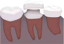 childdiet_img