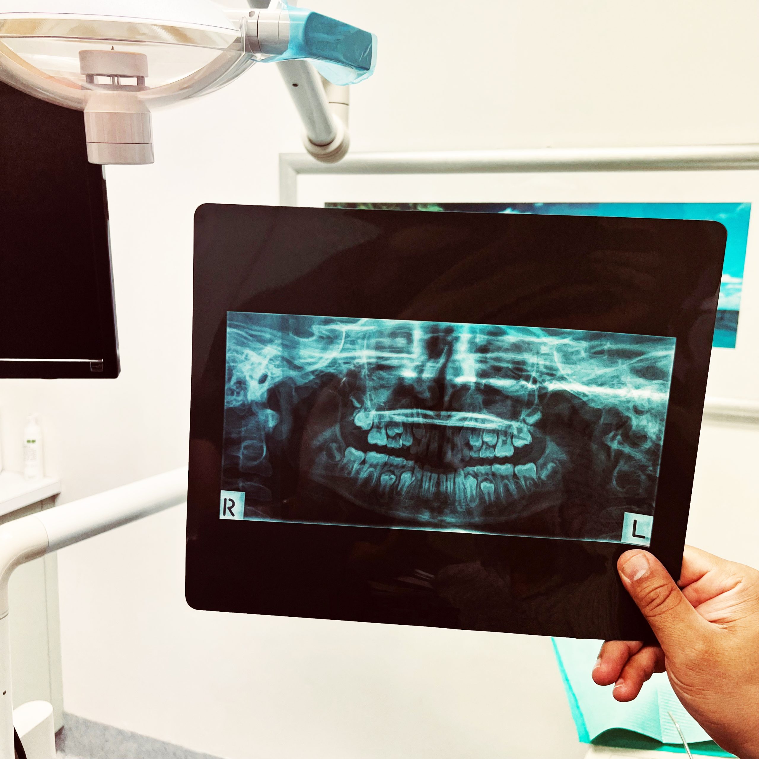 Digital X-rays
